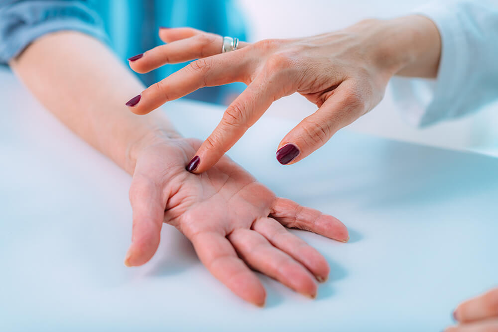 is dry needling an effective treatment for carpal tunnel? excel
